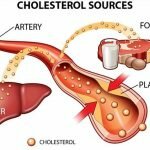 Thông tin về thành phần cholesterol toàn phần trong máu