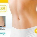 Kem chống rạn da Trilastin Stretch Mark