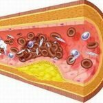 Các món cháo từ đậu ván chữa trị bệnh mỡ máu